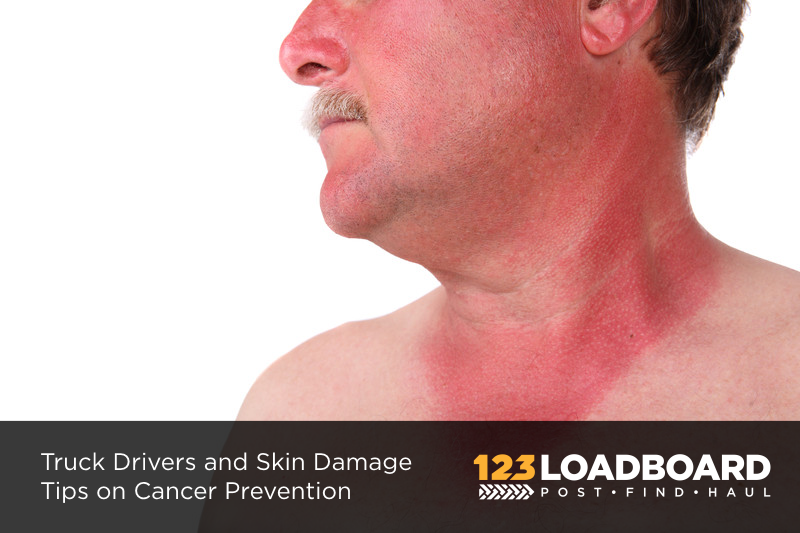 Skin Cancer